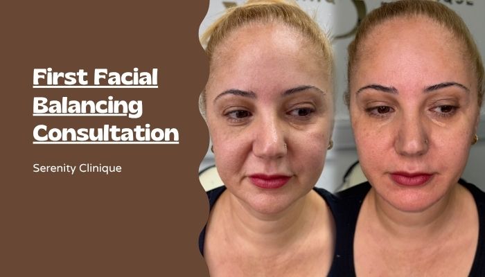 Facial Balancing