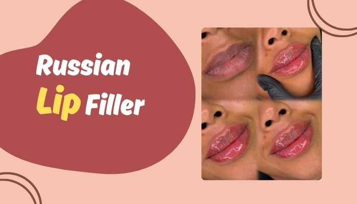 Russian Lip Filler